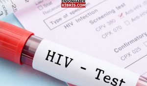 KIBRIS
                                        Bakanlık deklare etti… HIV virüsü taşıyan kişiye emek harcama izni verildi mi?